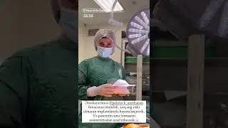 Ömürlük sinə implantı #plastikcerrahi #keşfet #youtubeshorts