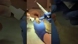 Зимбалова железа (Zymbal's gland) 