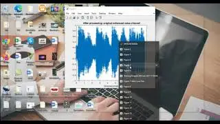 EEG Based Speech Recognition Matlab Simulation | EEG Based Speech Recognition Matlab Projects