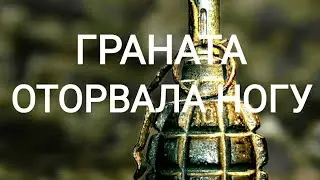 Взрыв гранаты оторвал ногу по ботинок
