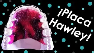 ¿Cómo hacer una placa Hawley?