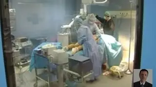La liposuccion