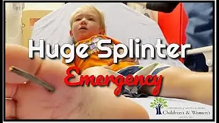 Huge Splinter Stuck in Toddler's Foot