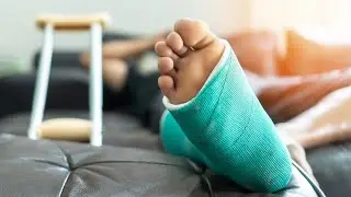 Foot|Sole surgery in 3D animation video 