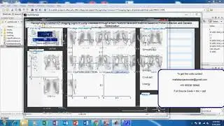 Recognizing common CT image matlab projects code