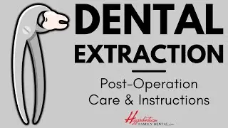 What To Do After Getting a Tooth Pulled | #experienceHFD