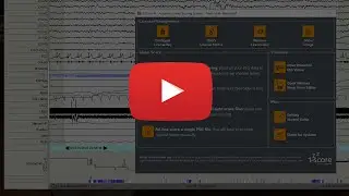 Z3Score Cloud AI Sleep Scoring - Getting Started Guide