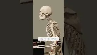 Почему укорачивается ПОЯСНИЧНАЯ МЫШЦА? ● Psoas release