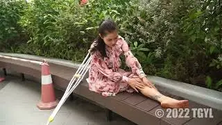 Jun amputee- A few random minutes