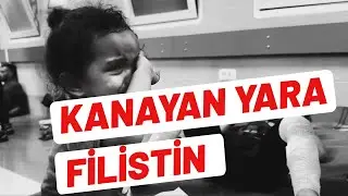 Kanayan Yara Filistin | Grup Furkan