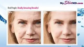 Revitol Phytoceramides Solution Review   Makes Skin Healthy And Look Years Youger