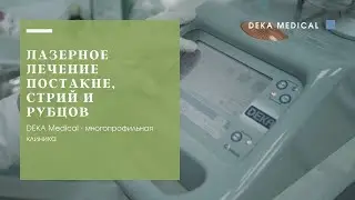 Лазерное лечение постакне, стрий и шрамов| DEKA SmartXide DOT