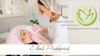 Как убрать носогубные складки, Подтяжка овала лица, Нитевой лифтинг, Нити с насечками