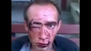 интервью гимнаста неудачника