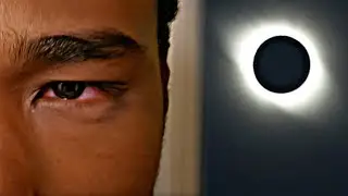 My Eyes After Looking At The Solar Eclipse