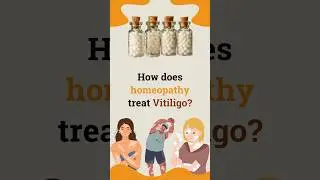 How does homeopathy treat Vitiligo? By Dr Rajesh Shah, MD (Hom) Life Force Homeopathy 