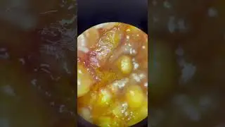 Черви и инжир 
