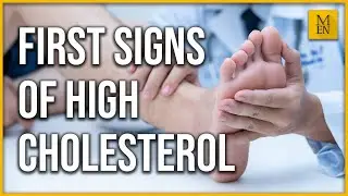 Things your toenails can say about your health