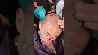 ⚡ЭКСКЛЮЗИВ ОТ МОРГЕНШТЕРНА!! ИНЦИДЕНТ ОТ ТРАВМЫ НА СЪЁМКЕ КЛИПА