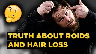 Vanity Biohacking vs. Performance Bodybuilding vs. Hair Loss Prevention 🤔