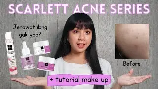 REVIEW SCARLETT ACNE SERIES + TUTORIAL MAKEUP SIMPLE