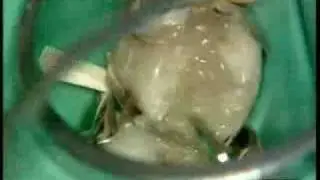 Universal flowable restorative Dr. P. Colon - X Flow /2