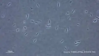 H. suis strain SNTW101c showing high motility