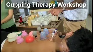 Types of Cupping Therapy
