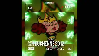3. G'S (Duchenne 2012)