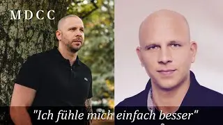 Haarpigmentierung Erfahrungen & Ergebnis Nach 3 Jahren | #haarpigmentierung