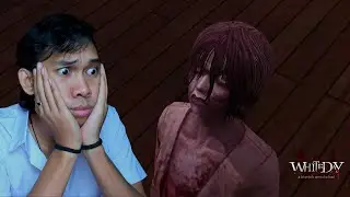 Dia Ingin Aku M*ti Terbakar !