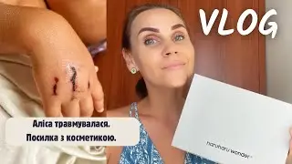 Аліса травмувалася. Посилка з косметикою.