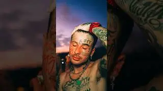 Duzz tendo as tatuagens removidas 