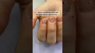 My nails will stay ugly forever?! 😢