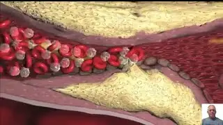 KANGEN voda - Lekári skúsenosti