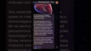 Срочно! Ютуб умирает!! Подпишитесь на телеграмм, чтобы не потерять #факты #history #интересныефакты