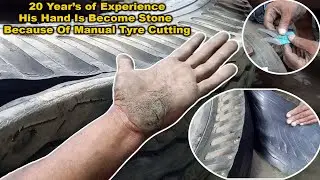 His Hand Is Become Stone Because Of Manual Tyre Cutting