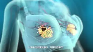 AI Bra 智能理疗内衣