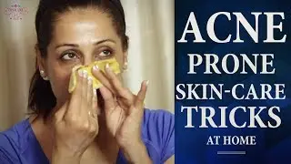 Tips and Secrets for Acne Prone Skin | How To Get Clear Skin |Beauty Tricks for Glowing Skin at Home