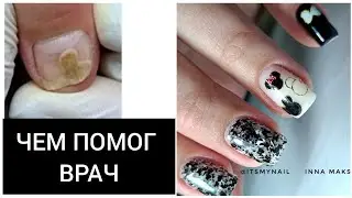 вот и СХОДИЛА к ВРАЧУ