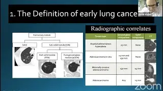 The Role of Surgery for Early Lung Cancer Segmentectomy and Lobectomy: Birmingham Review Course 2021