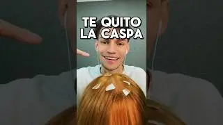 ￼TE QUITO LA CASPA #asmr #shorts #asmrvideos #comedia