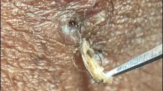 EXTRACT WITH ME!