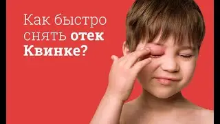 Как помочь при отеке Квинке?