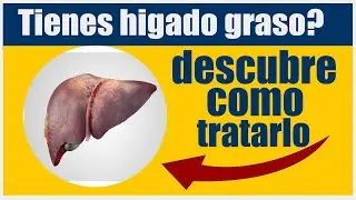 si tienes Hígado Graso descubre como tratarlo