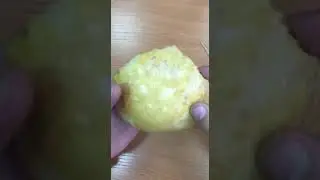 Теменная кость Анатомия