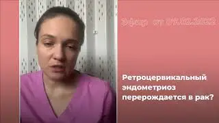 Ретроцервикальный эндометриоз перерождается в рак?