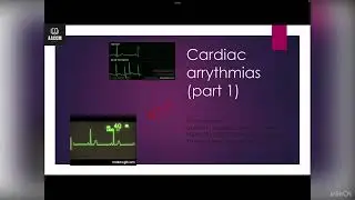 Cardiac arrhythmias part 1