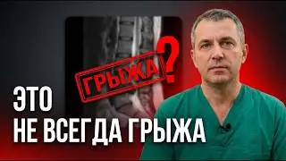 ПОЯСНИЦА БОЛИТ НЕ ОТ ВОЗРАСТА- что реально делать после 50. 4 причины, о которых вам не говорят.
