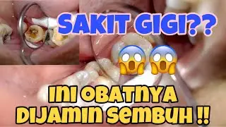 SAKIT GIGI?? SUDAH MINUM OBAT TAK KUNJUNG SEMBUH?? INI SOLUSINYA !!